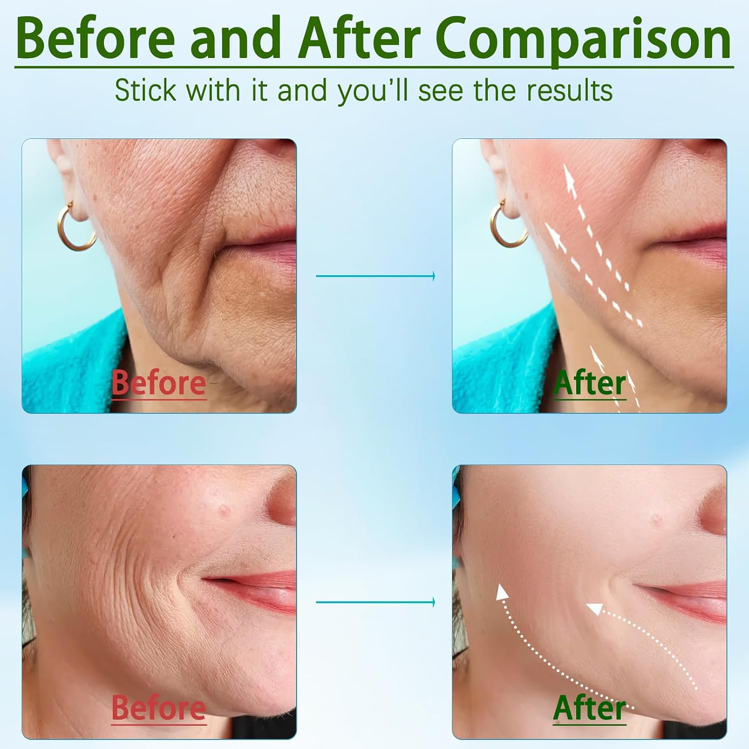 Electric Facial Massager & Skin Tightening Device – Face & Neck Beauty Massager with Heat Therapy